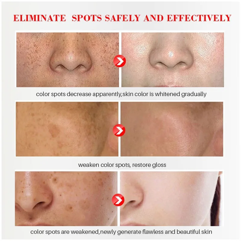 Effective Whitening Freckles C - Licorice Root Sticks recension och pris