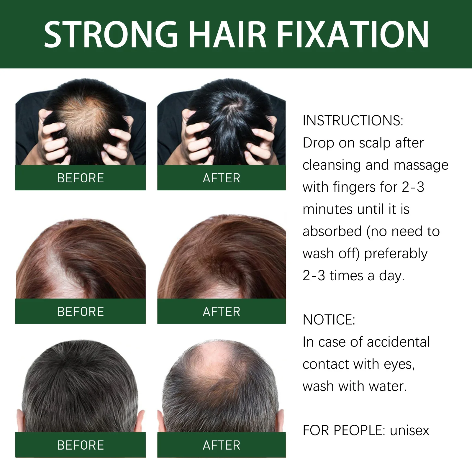 7 Days Ginger Hair Growth Prod - Licorice Root Sticks recension och pris