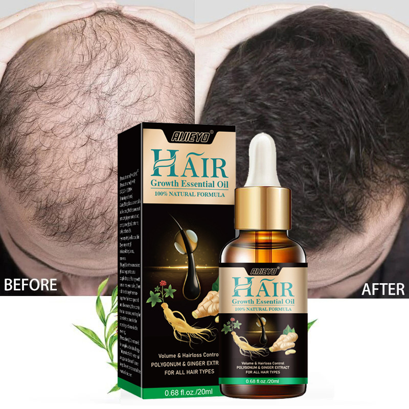 2023 Biotin Fast Hair Growth O - Licorice Root Sticks recension och pris