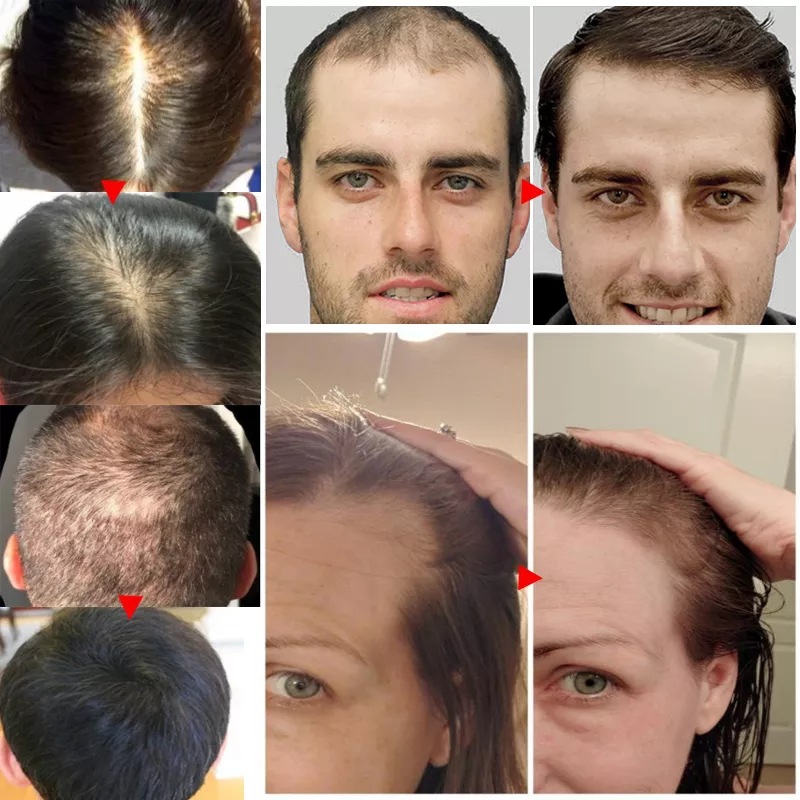 2023 Biotin Fast Hair Growth O - Licorice Root Sticks recension och pris