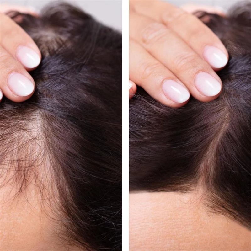 2023 Biotin Fast Hair Growth O - Licorice Root Sticks recension och pris