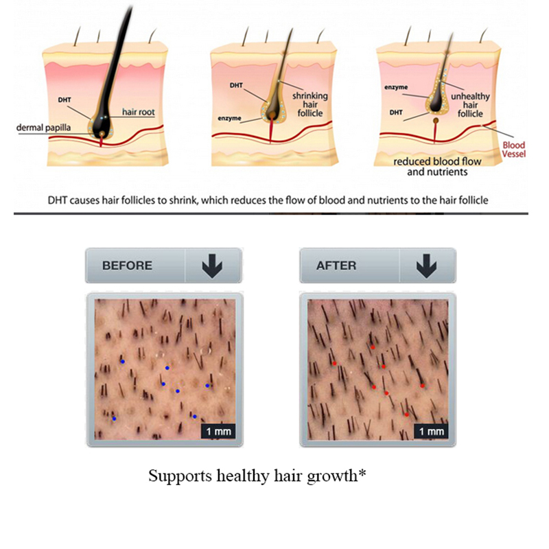 PURC 100ml Ginger Hair Loss Sh - Licorice Root Sticks recension och pris